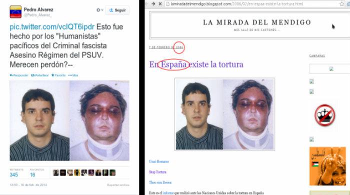 Ein besonders perfides Beispiel: Dieses Bild zeigt den Basken Unai Romano, der von der spanischen Guardia Civil gefoltert wurde. Der Vorwurf in diesem "Tweet": Das "faschistische" und "mörderische" Regime der PSUV von Nicolás Maduro habe ihn so zugerichtet
