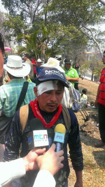 Einer der Verletzten war Francisco Sanchez vom Indigenen Rat aus Rio Blanco