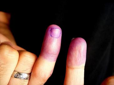 In vielen Ländern in Lateinamerika und der Karibik tauchen Wähler nach der Stimmabgabe ihre Finger in Tinte. So sollen Doppelabstimmungen verhindert werden. Dieses Foto stammt aus Venezuela